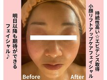タイカ(Taika)の雰囲気（【メディア雑誌/即実感★】たるみ/しわ/小顔悩みなら当店で♪）