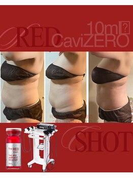 スズ(SUZU)の写真/REDSHOT、ダブルキャビテーションでしっかりサイズダウン！