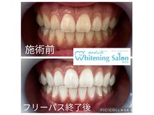 ホワイトニングサロン 四日市white