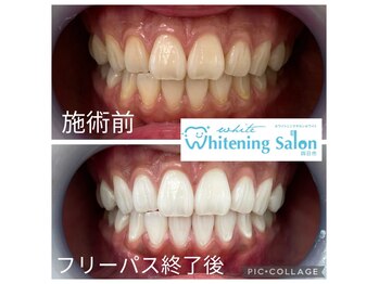 ホワイトニングサロン 四日市white