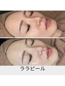 リムビューティー 自由が丘(RymBeauty)/うる艶、発光肌になります