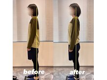 スリーエス 京都四条烏丸Studio(SSS)/実際の施術前後の変化5