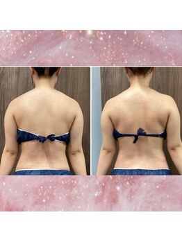 プリマプリート 可児店/筋膜リリースで華奢見せ♪