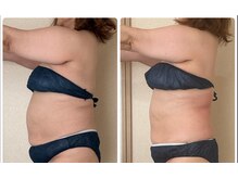 リノ(Lino)/大人気！本気のダイエット！！