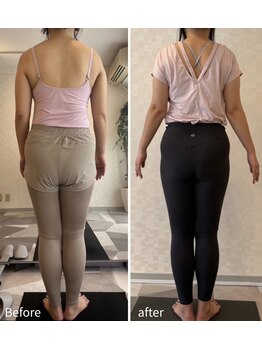 ジュノ(JUNO)/骨盤バランスでヒップライン変化