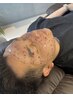 【全員】フルフェイシャルワックス(眉毛込み)+ハイドロジェリーマスク