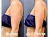 【会員/回数券様★夏限定】今年こそノースリーブが着れる!二の腕美容整体