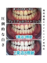 ホワイトニングビューティー つくば店/短期間で真っ白に！！