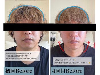 エン(EN。)/小顔矯正ヘッドスパ*施術症例1