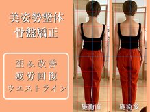 リブ(LIB)/骨盤矯正＋美姿勢整体14