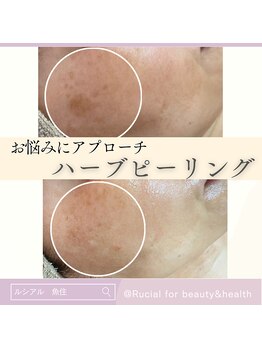 ルシアル(Rucial)/継続は美肌へと、裏切りません！