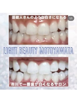 ライトビューティー 本八幡店(LIGHT BEAUTY)/スタッフの歯です♪