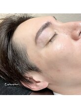 エン 中崎町(enn.)/メンズ眉毛