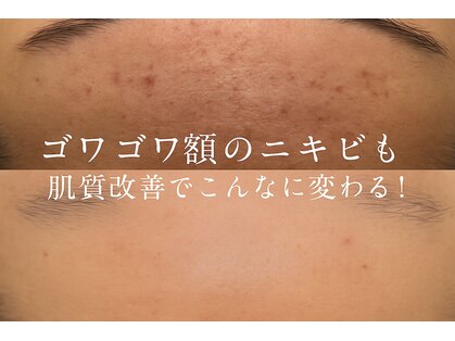 エメ(Aimer)の写真