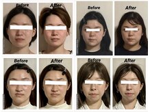 メディカルエステティックサロン リラックスイン(Relaxinn)/