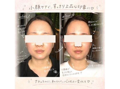 ハルハル(Haru Haru)の写真