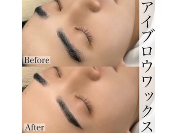 アール(R)/