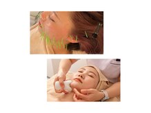 リピート率No.1！美容鍼〈リフトアップ・小顔・肌質改善◎〉