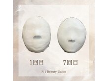 R-1ビューティーサロン 表参道/Before &After（７回）