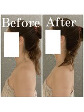 リプロ(RE:PRO)/整う骨盤姿勢コース