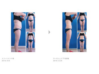 Nビューティー/最新エンダモロジーBODY