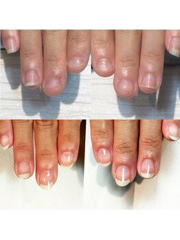 キュア(Cure.)/3回目のご来店で既に美爪