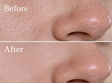 ボーテスキンクリニックの雰囲気（黒ずみ・つまり・開き毛穴をハーブピーリングでケア）