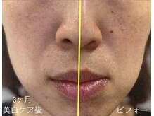 アンジェリークの雰囲気（30代女子　最新美容成分ナイアシンアミドしわにもシミにも期待大）