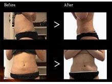 痩身！ハンド＆インパクトでのマッサージ☆プリドルエッセンス