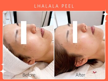 シロカネ イオンタウン西熊本店(SHIROKANE)/韓国肌管理ララピール☆