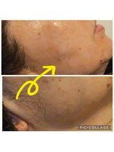 ミホズルーム(Miho‘s room)/肌が変わると気分も上がる