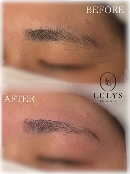LULYS【ルリス】の写真/VIO・眉毛・ヒゲなどデザイン脱毛にも対応♪