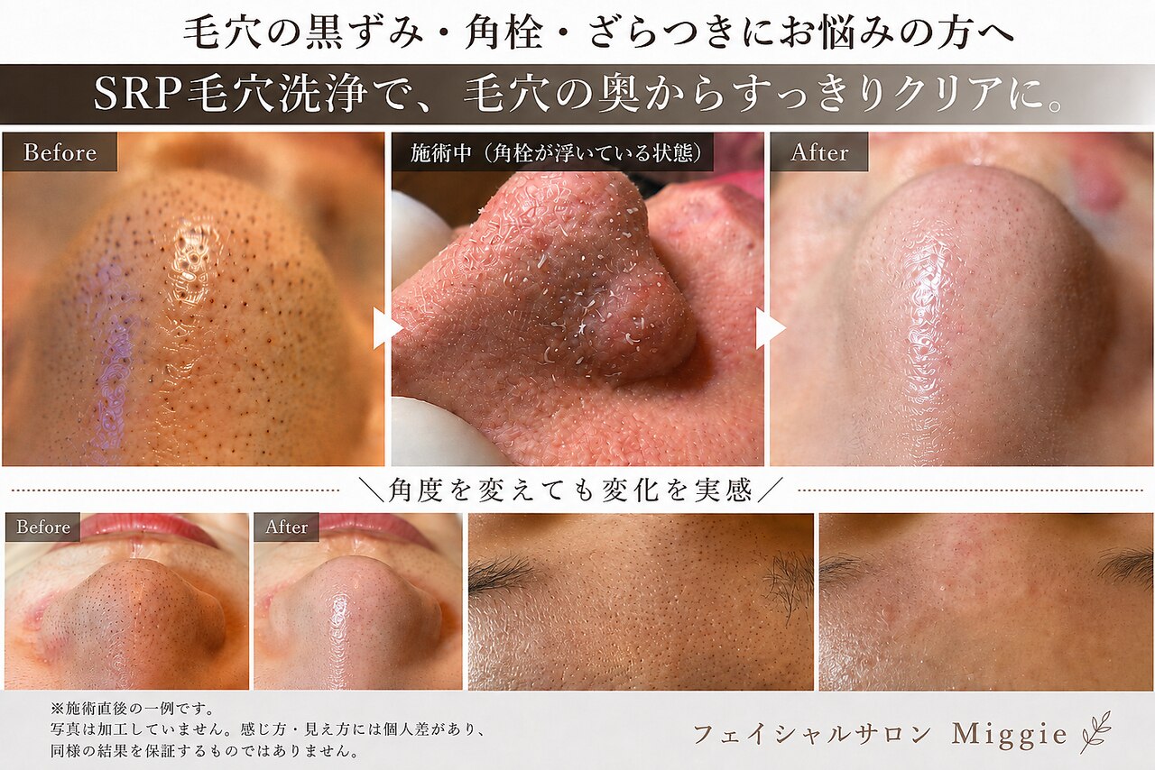 フェイシャルサロン ミギー(Miggie)｜ホットペッパービューティー