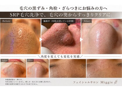 フェイシャルサロン ミギー(Miggie)の写真