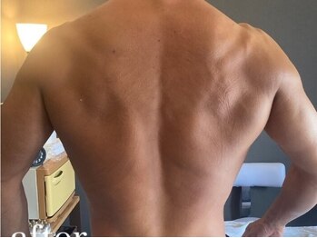 リジュ(Reju)/肩凝り改善にも効果