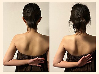 ラフリー 天神赤坂院(RUFFREE)/圧倒的変化を実現【天神赤坂】