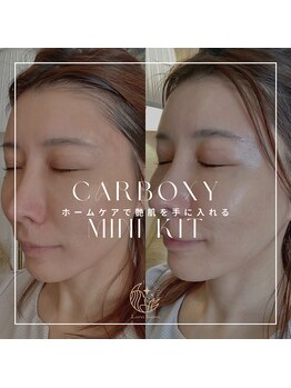 ララルアナ(Lara luana)/カーボキシーホームケア