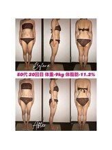 シェイプ 浜松本店/美腕も目指すシェイプ浜松本店