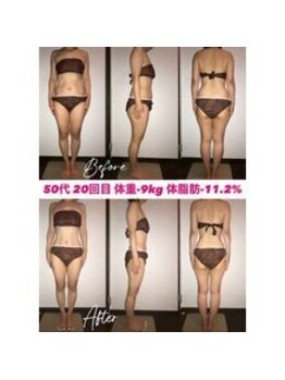 シェイプ 浜松本店/美腕も目指すシェイプ浜松本店