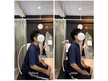 ナオル整体 広島福山院(NAORU整体)/猫背/巻き肩→Before/After
