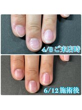 ヴィヴィアナ(VIVIANA)/地爪育成