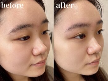 エミュ(e'mu)/左右差にお悩みがある方必見