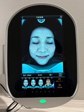 「詰まり」か「たるみ」か。毛穴悩み、その正体を画像解析で判別