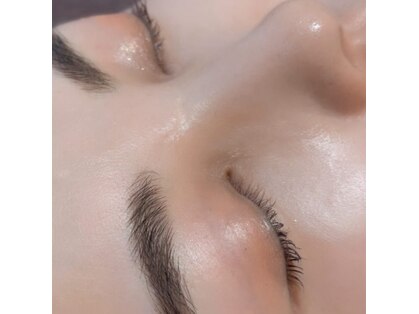 ビジュネ(Bijounet)の写真