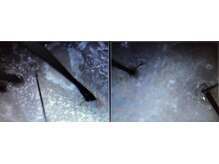 シルフ エルスパ 阪急茨木店(Sylph &EirSPA)/