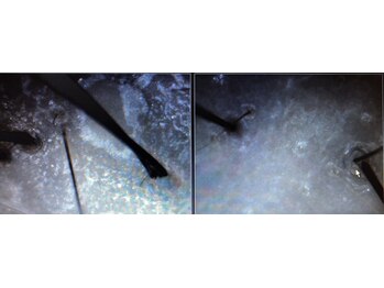 シルフ エルスパ 阪急茨木店(Sylph &EirSPA)/