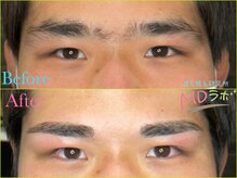 エムディラボ 金沢竪町店(MDラボ)/BeforeAfter