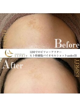 エスプリ 銀座店/シミたるみ改善・ホワイトニング