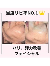 シン(Shin)/【人気No.1フェイシャル】