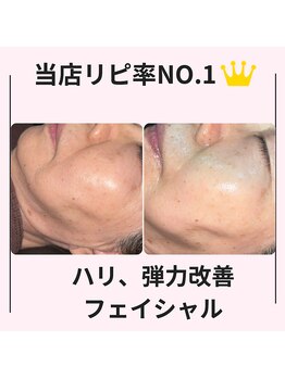 シン(Shin)/【人気No.1フェイシャル】